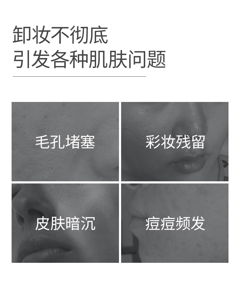澳兰黛备孕妇女可用氨基酸卸妆水面部专用温润清洁卸妆油卸妆乳 — 3