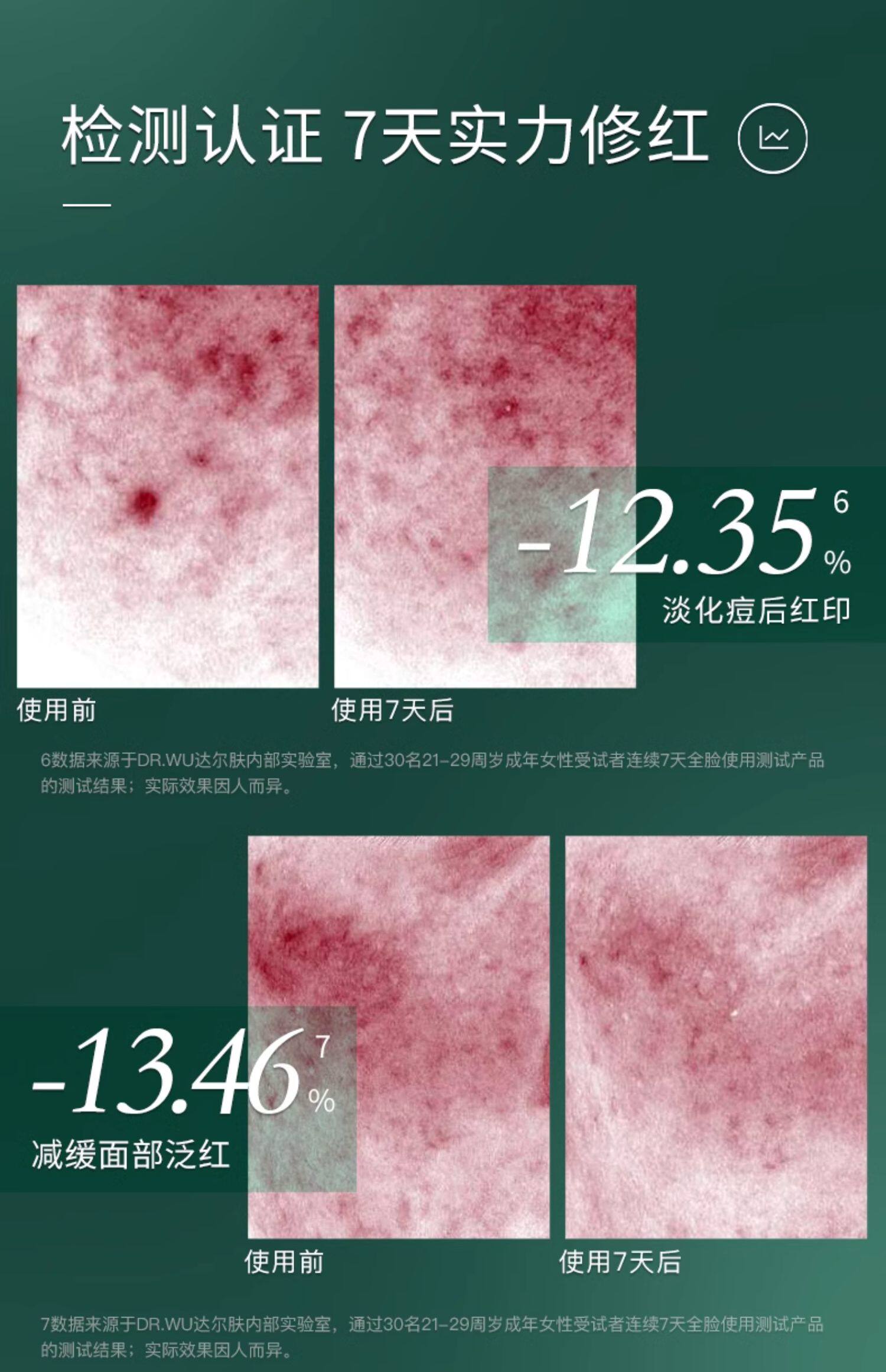 【中国直邮】 达尔肤 三重修护精华 修护泛红淡痘后红印维稳屏障  15ml