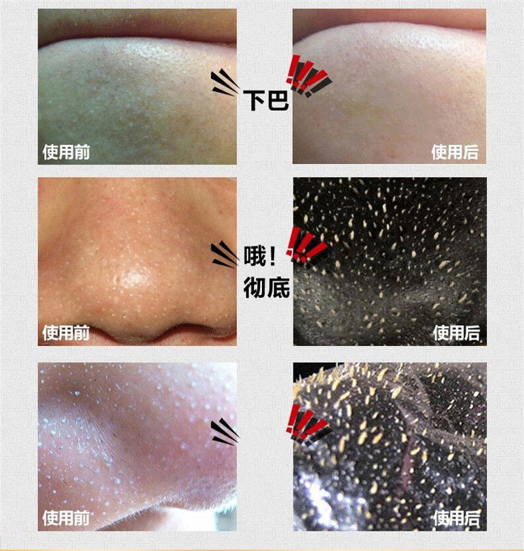 Подробная информация о бамбуковых углях на носовых мембранах_13