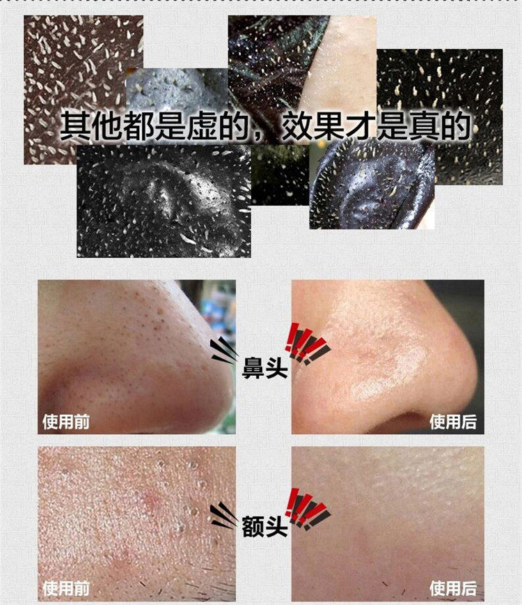 Подробная информация о бамбуковых угольных назальных мембранных срезах_12