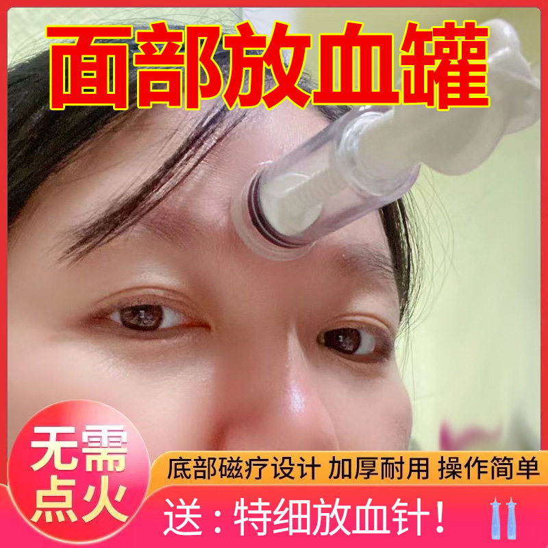 面部泄血罐放血罐脸部拔罐器拔青春痘粉刺吸罐手拧吸力大力度美容