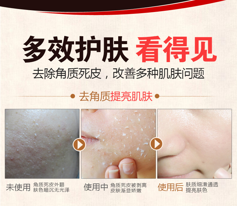 Tẩy tế bào chết cho da mặt nữ toàn thân Gel rửa mặt toàn thân Làm sạch sâu tẩy tế bào chết mụn đầu trắng tẩy tế bào chết