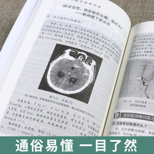 神经内科医师查房手册 神经内科书籍 神经内科疾病诊疗指南护理 实用神经内科学医嘱速查手册 叩诊锤神经内科主治住院医师手册用书