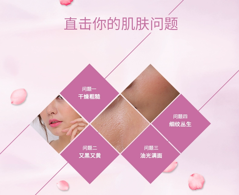 Vitamin E kem dưỡng ẩm kem ve kem sữa cơ thể mùa thu và mùa đông chăm sóc da sữa sinh viên nam giới và phụ nữ kem tái tạo da mặt