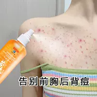 [Взрыв маленькой красной книги] Не используйте чувствительные мышцы мужчин и женщин позади Дуду позади Дуду. Вы можете купить 2 Get 1 ~ 1 ~