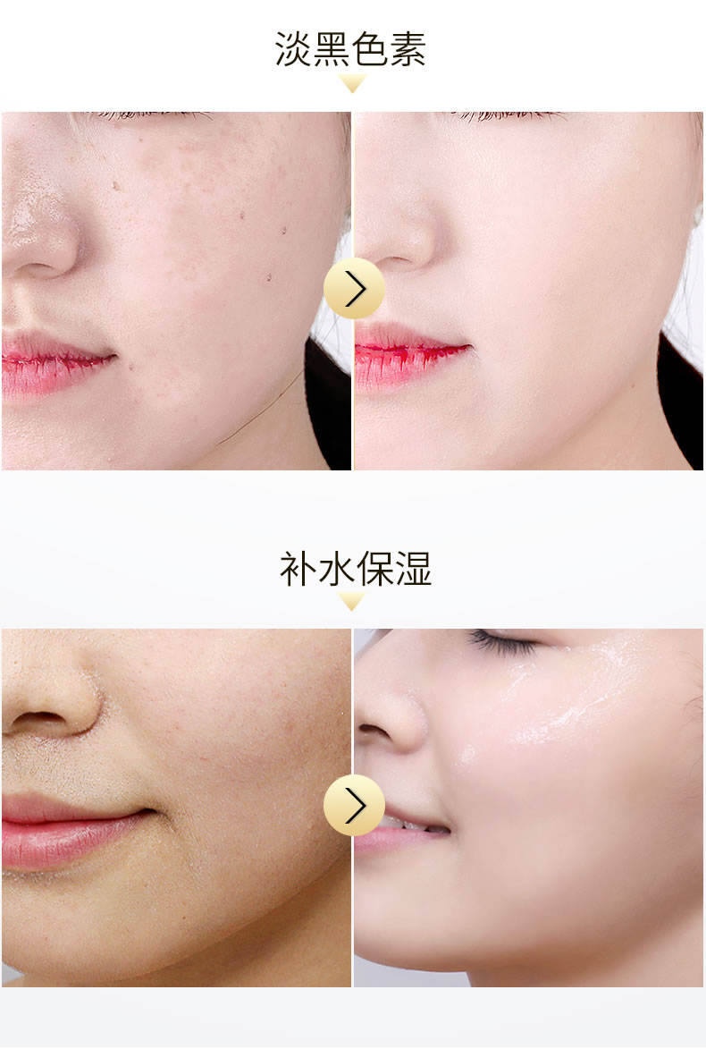 Fanxi B3 niacinamide giải pháp dưỡng ẩm và làm sáng màu da thu nhỏ lỗ chân lông axit hyaluronic tinh chất ohui