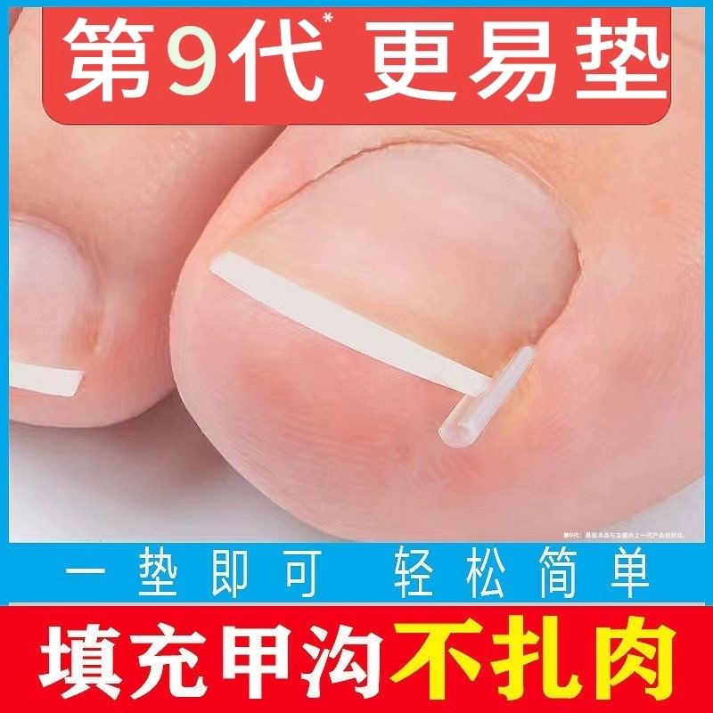 Japanese Ingrown Toenail Corrector, Specialized Isolation and Filling Pads for Correcting Ingrown Toenails and Preventing Nail Inflammation