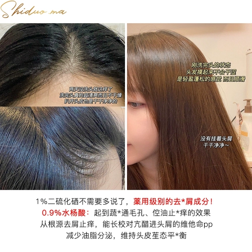 Пылесос, успокаивающий гигиенический шампунь для мытья головы, удаление перхоти, против зуда