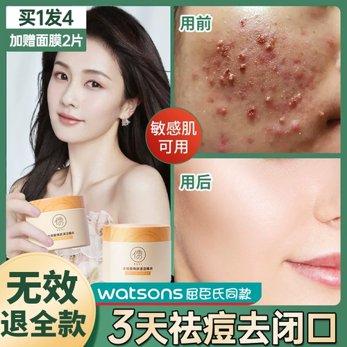 Ватные диски с салициловой кислотой от черных точек подходит для мужчин и женщин, анти-акне, скрывает прыщи, сужает поры