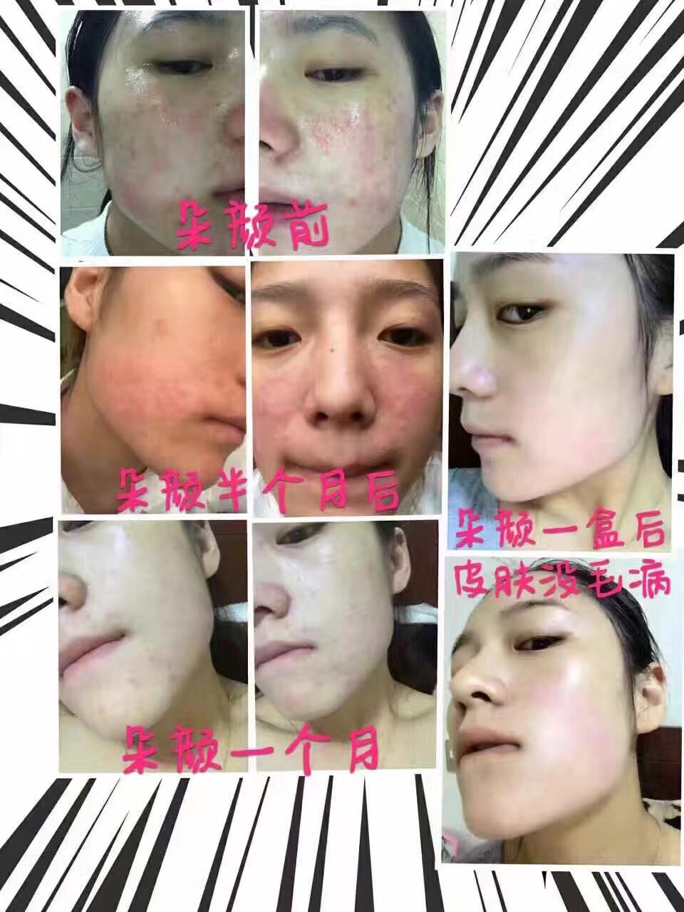[] mặt nạ dưỡng trắng