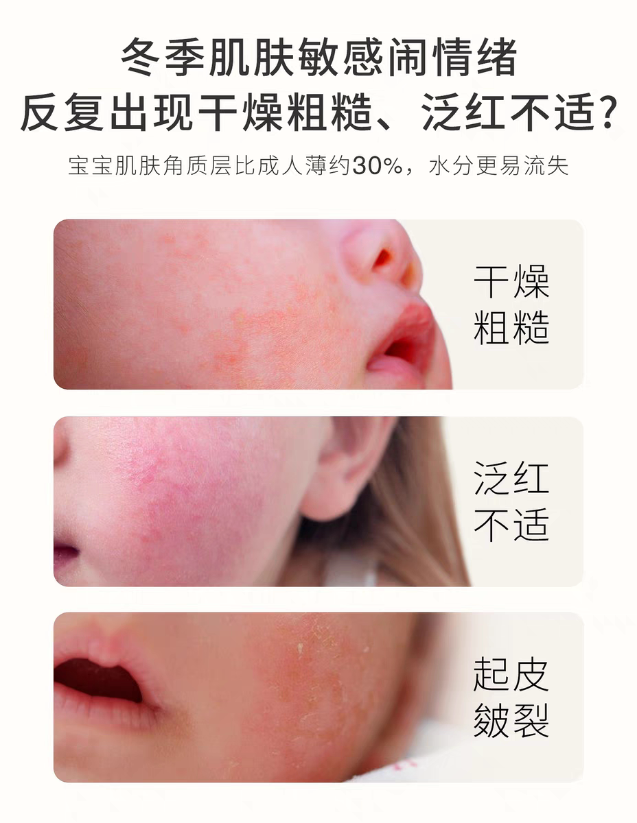 Ребенок лосьоны/кремы 亲初马油面霜婴儿宝宝润肤霜新生婴幼儿秋冬季防皴防裂儿童防冻膏