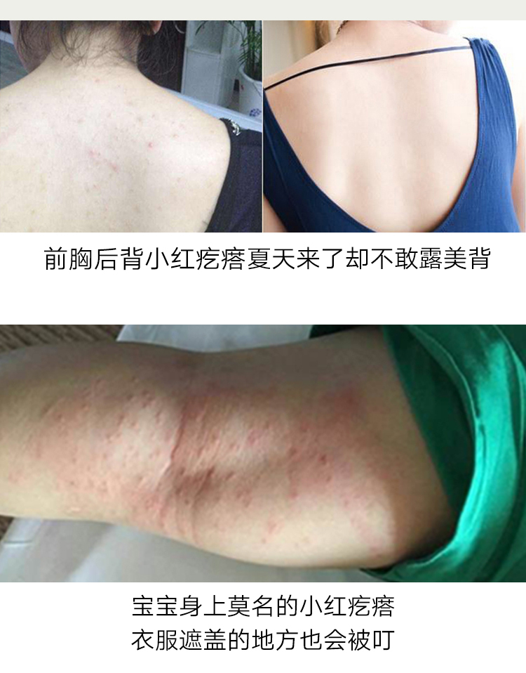 bình xịt côn trùng tốt nhất Man Ting Green Pepper Loại bỏ Aphid Spray Spray Liquid Non-Ghd Bộ đồ giường Gia đình Giặt chống bụi - Thuốc diệt côn trùng bình xịt diệt khuẩn