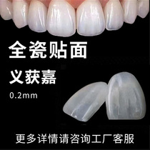 Teeth veneers all-ceramic veneers Ivoclar dental veneers all-ceramic veneers whitening teeth veneers