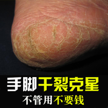 Sea Kings heel dry crack cream anti-cracking chapped crack hand and foot crack cream repair and moisturizing horse oil