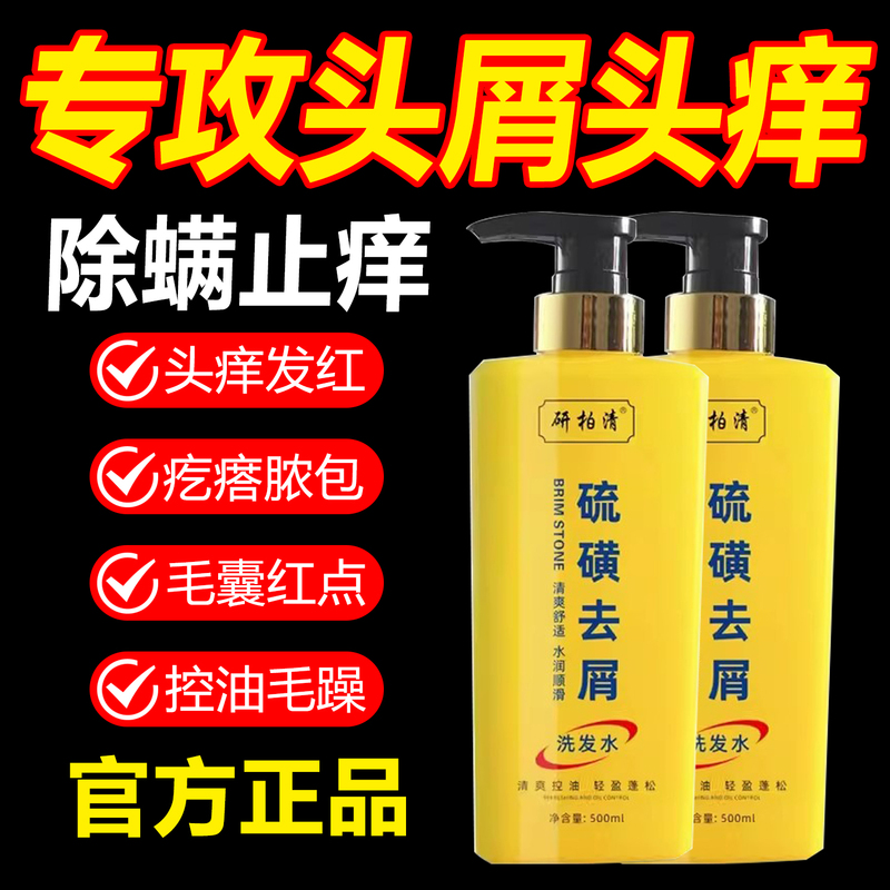 Sulfur Anti-Dandruff, Anti-Itch, Oil-Control, Fluffy Shampoo for Men, Girls, Children and Teenagers, Anti-Mite Shampoo, Genuine Product