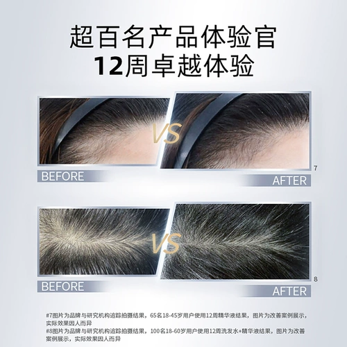 Эссенция, шампунь для кожи головы, лосьон для волос, контроль жирного блеска, придает объем