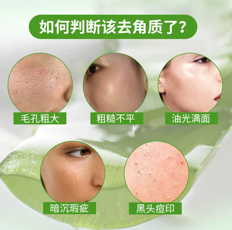 Aloe Vera Exfoliating Gel Facial Deep Cleansing Face Dead Skin Stained Mud Blackhead Gel Scrub tẩy tế bào chết dạng gel