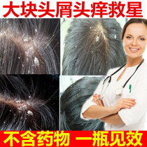  Anti-dandruff anti-itching artifact Oil control Anti-dandruff shampoo Scalp itchy large seborrheic nemesis Lady oil removal