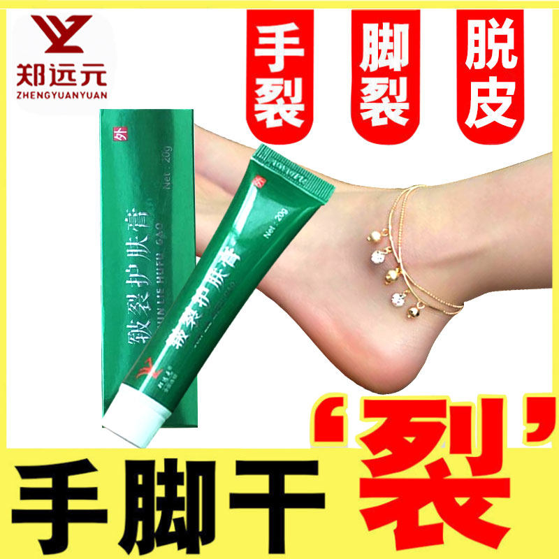 (Buy 5 send 1) Cracked Skin Care Cream for hand foot heel dry crack Zheng Yuanyuan official flagship store