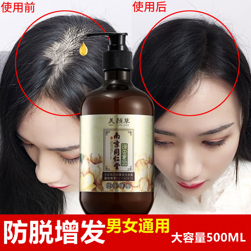 Hominin Hall ginger anti-hair loss shampoo for men and women with hair and hair growth and hair-free silicone oil control dew