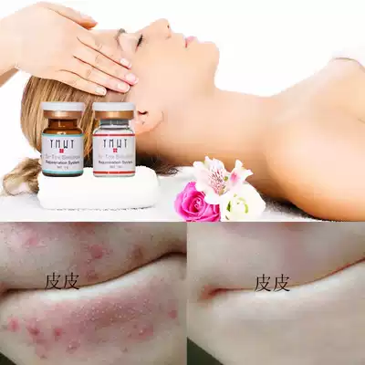 Rescue problem muscle Swiss YMWT seaweed Silicon needle sponge microneedle acne closed acne scar pigment pores