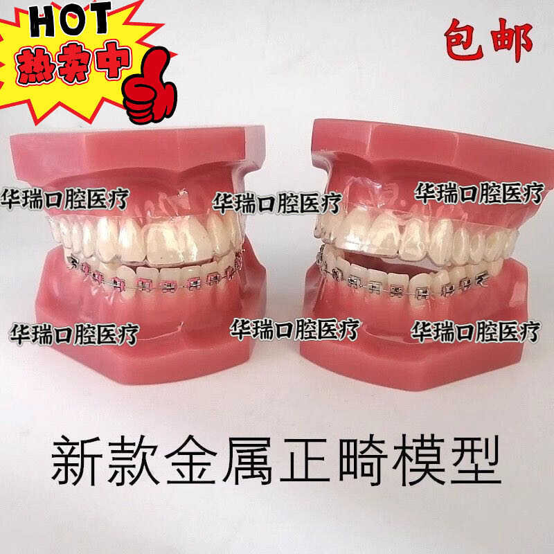 牙科口腔教学模型隐形正畸矫正模型金属正畸模型口腔展示模型