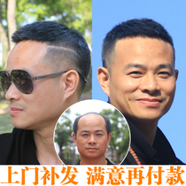 Dawning wig mens door-to-door custom woven hair replacement mens short hair Korean version of handsome biological scalp overhead wig film