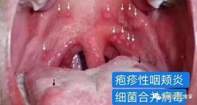 读懂小儿化验单 血常规各项指标代表当前身体状况的意义-图片8