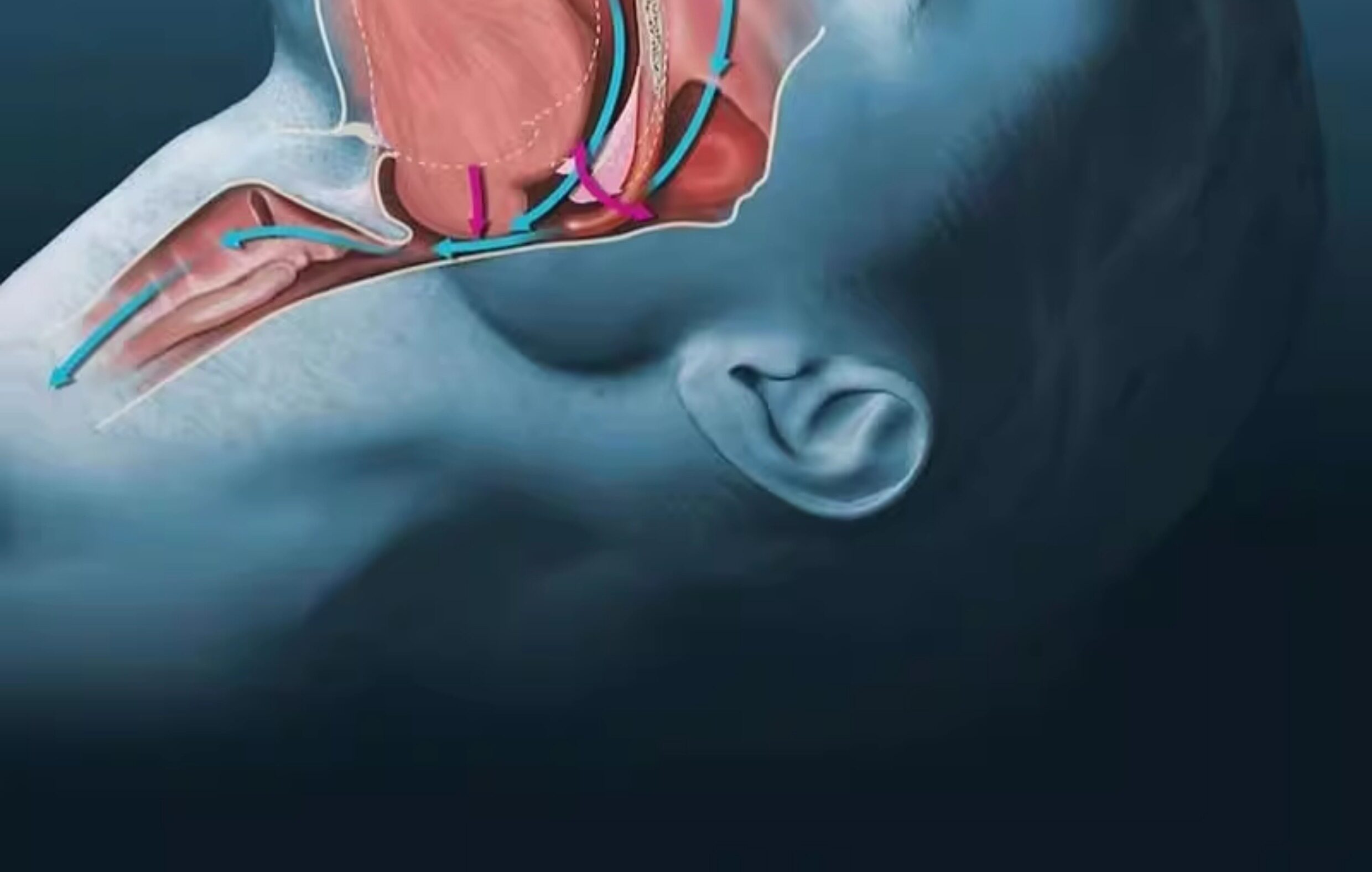 Анти-храп продукты 鼻腔呼吸扩张器磁吸性鼻带贴片鼻子鼻孔通气扩鼻呼吸神器防打呼