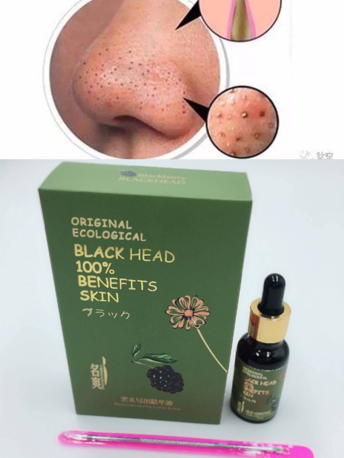 Famous Black Head Export Fine China Liquid Goodbye Strawberry Nose Lasting Repair Pores Gradually Layer Fine Skin Acne New Products