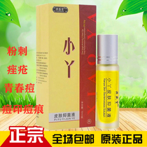 2 sends 1 bean little girl Chinese liquid male and female student acne acne Acne Acne pimple acne Acne Cream