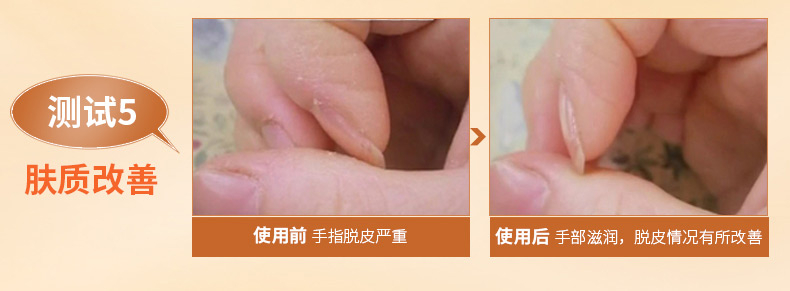 Chụp hai viên kem dưỡng ẩm da cừu Úc kem dưỡng ẩm giữ ẩm kem dưỡng ẩm kem dưỡng ẩm chăm sóc da - Kem dưỡng da hada labo dưỡng ẩm