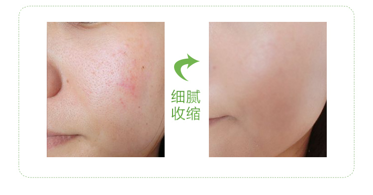 Bạc hà mặt massage mặt kem làm sạch kem trị mụn sâu làm sạch và làm sạch lỗ chân lông thẩm mỹ viện đặc biệt thương hiệu sáp tẩy trang clinique