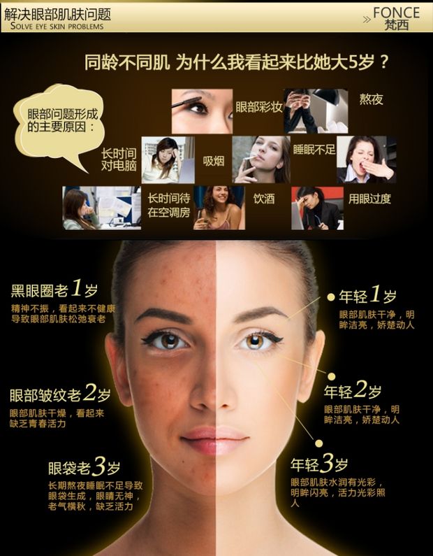 Fanxi để quầng thâm mắt kem mắt túi khô dòng chống nhăn chăm sóc mắt làm mờ nếp nhăn giữ ẩm kem mắt nào tốt