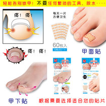 Japanese nail patch nail groove embedded nail corrector inflammation toenail patch special Lara nail clipper pedicure knife tool