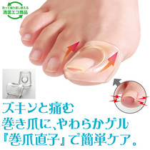 Japanese nail patch set nail groove embedded nail corrector inflammation toenail special lesbian nail artifact correction correction