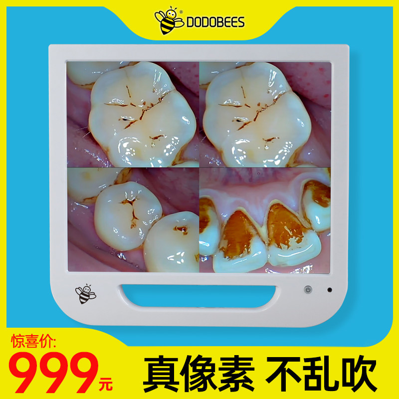 Small Bee Dentistry Endoscopy All Oral High Picture Quality Photographic Head Apparatus Materials Dentist Teeth Tools