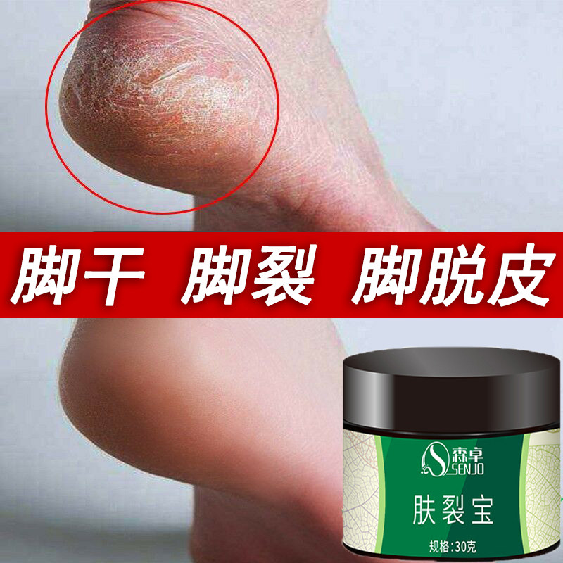 Heel crack repair cream crack skin crack dry chapped protective hand and foot crack anti-crack peeling moisturizing cream