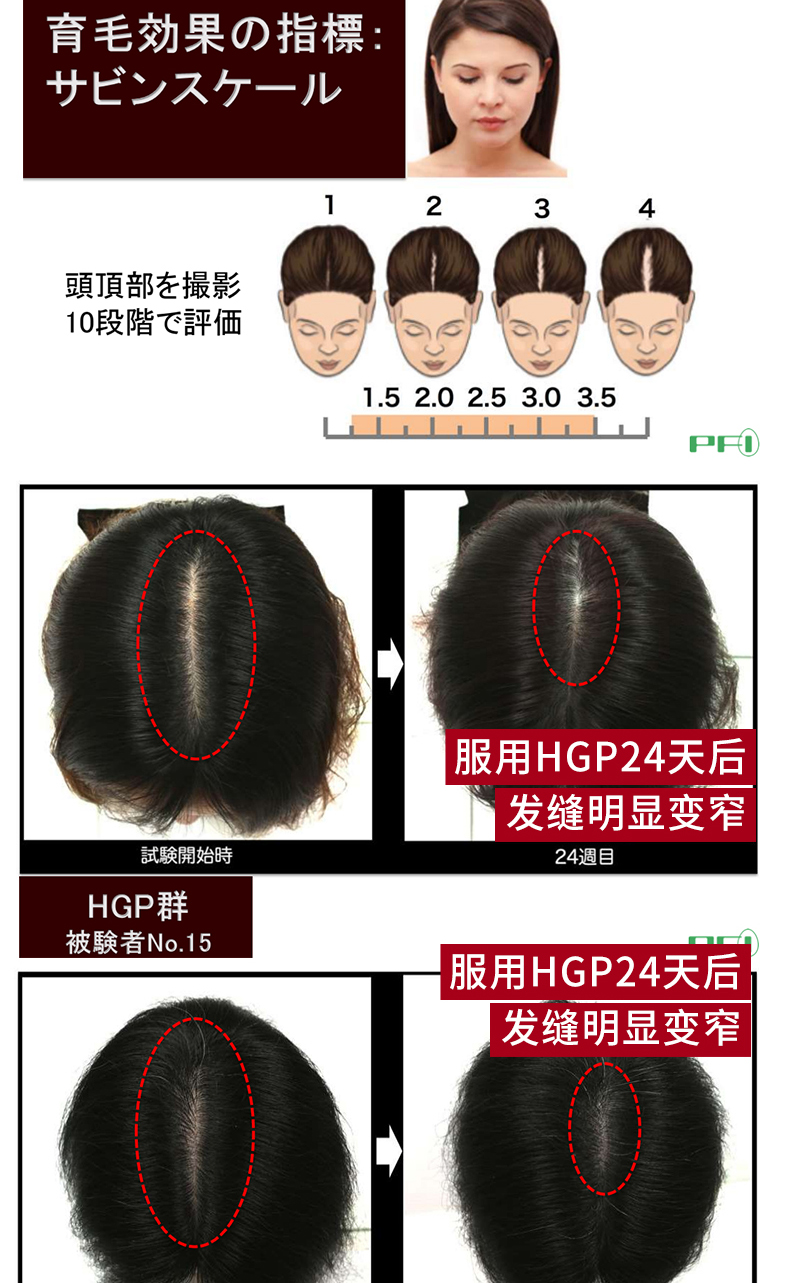 【日本直邮】plamine健美三源增发粉调理脱肤质护理生发养发浓密  30条