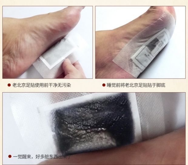 Xác thực Bắc Kinh cũ dán chân ngải cứu chân giấm tre dán chân chăm sóc chân Ai Ye chân dán kem dưỡng da chân