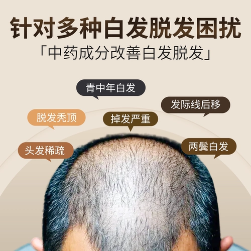 七宝 Мейранский пероральный жидкость Бушен Ренфей Ван Ф.С. Бушен печень и болезненность почек и болезненность печени и колена, официальное флагманское восстановление ранних белых волос