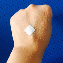 PU round Band-Aid baby baby waterproof pinhole patch mole paste acne patch 50 pieces