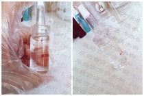 Clear Hyaluronic Acid Solution soft 10ML