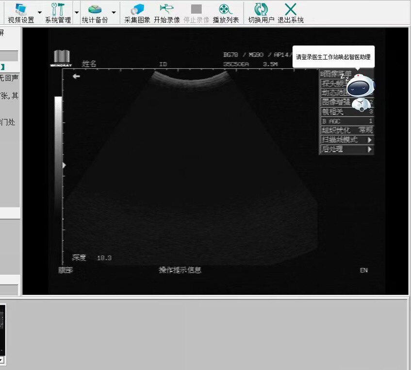 维修b超声工作站软件彩超软件黑白b超采集卡迈瑞血常规血球仪