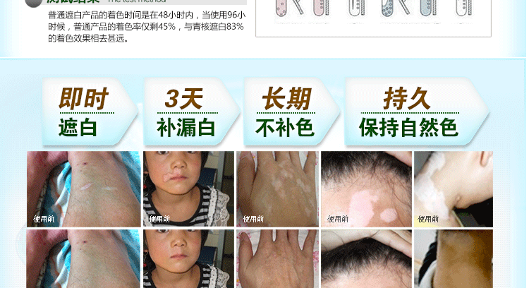 液 美 霖 青 核 白癜风 遮 液 vĩnh viễn không thấm nước màu trắng tại chỗ bên ngoài kem che khuyết điểm để gửi bàn chải da màu xách tay