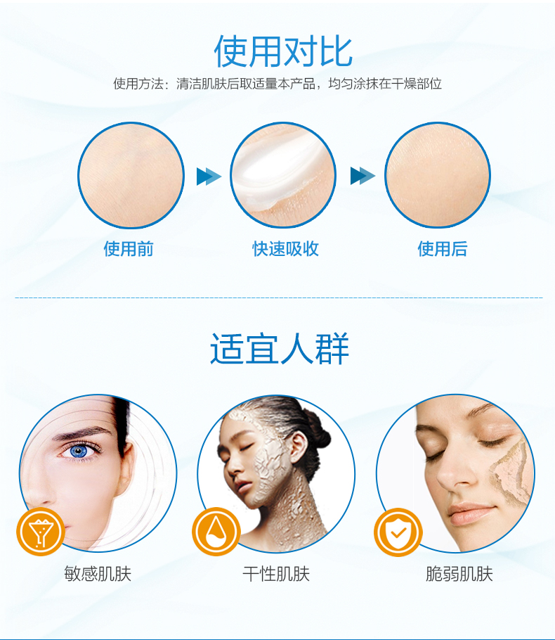 Kem dưỡng ẩm Aussie Ego QV Kem dưỡng ẩm Kem dưỡng da dành cho gia đình 100g - Kem dưỡng da kem dưỡng ẩm da dầu mụn