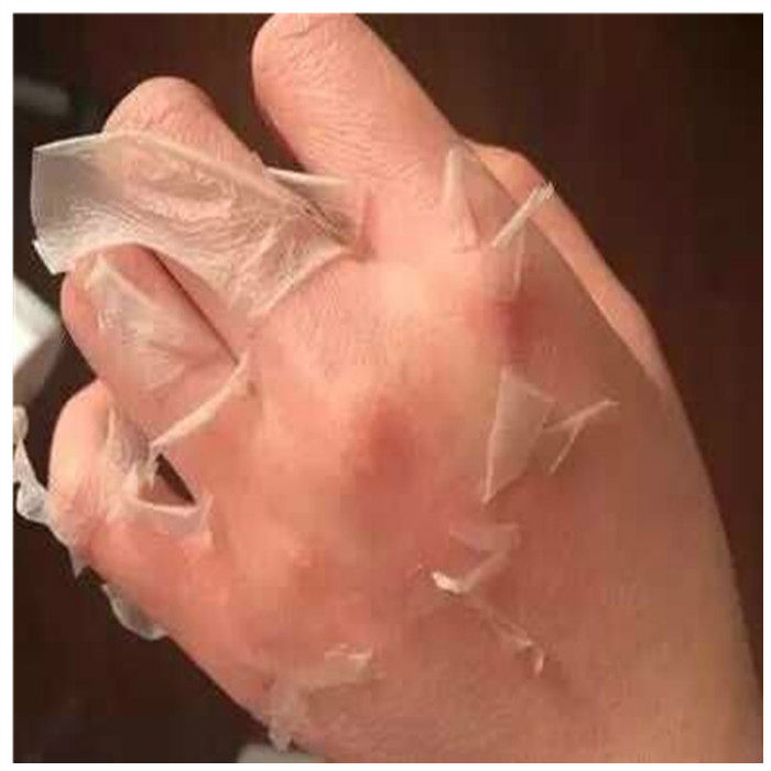 买2发5脱皮手膜去死皮粗糙老茧去角质嫩手套细嫩手部护理去手老皮