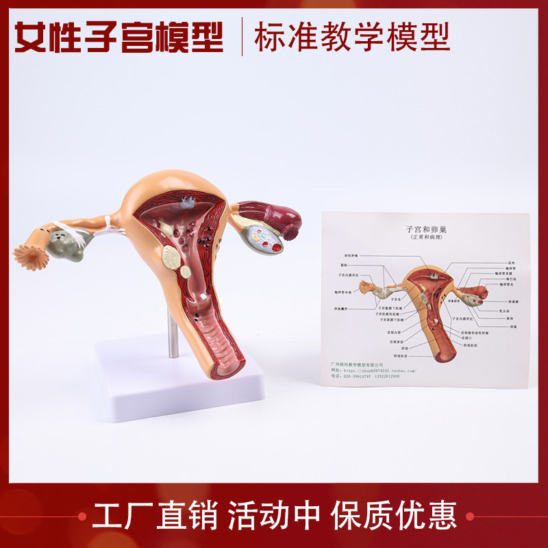 厂价直销女性内外生殖器解剖模型卵巢子宫避孕指导模型 计生模型