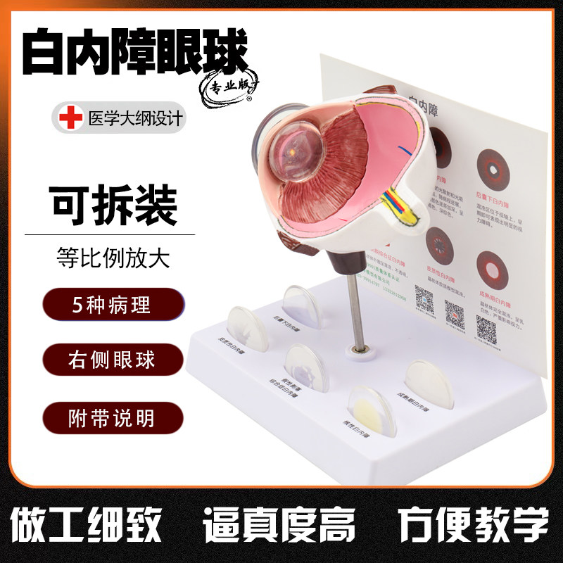 白内障眼球模型病理人体眼球结构眼睛解剖模型医院学校用教学演示
