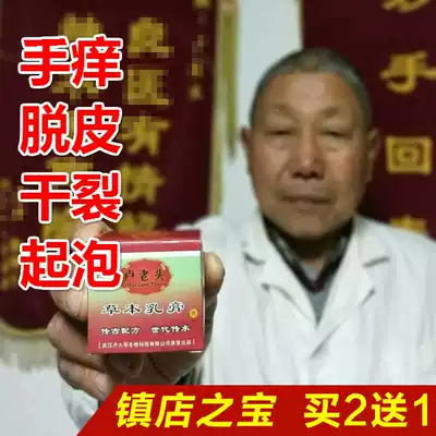 Hand molting, hands, small blisters, dry fingers, itching, peeling, itching, palms, old man Lu, herbal cream